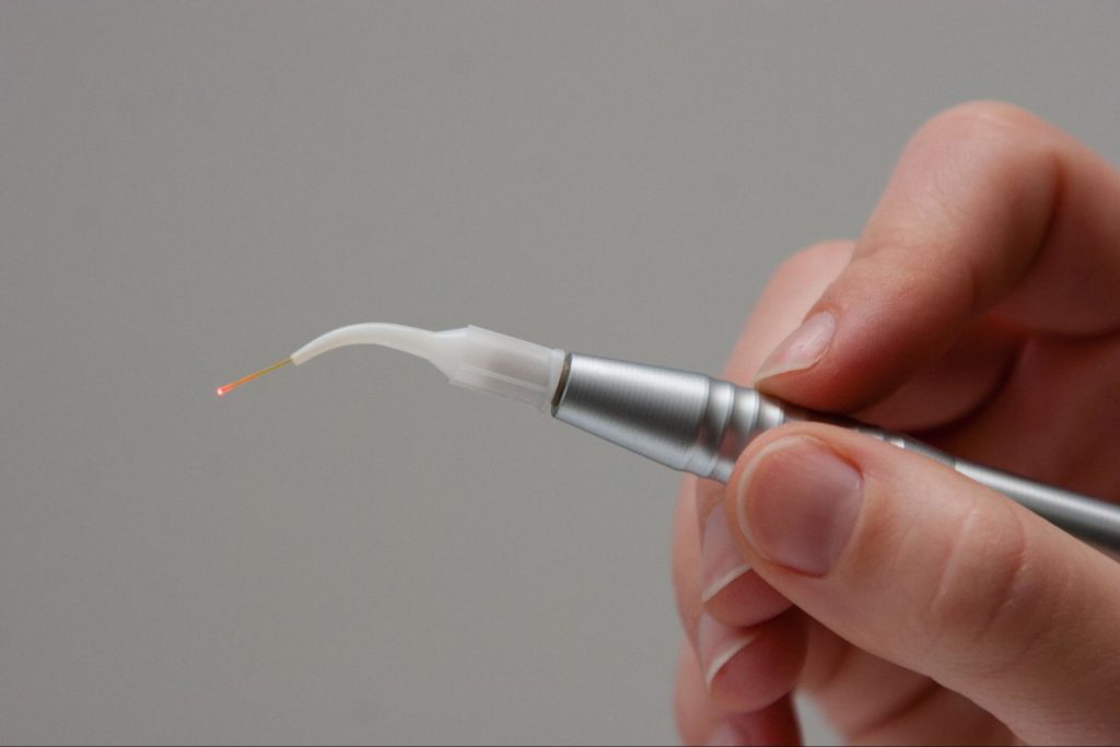 Laser dental tool used to remove unhealthy gum tissue