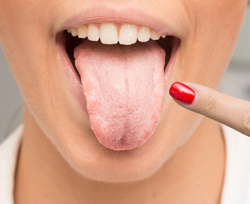 Person pointing at their healthy tongue