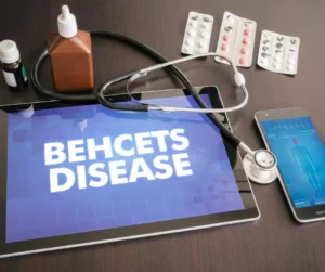 Tablet with Behcet's Disease